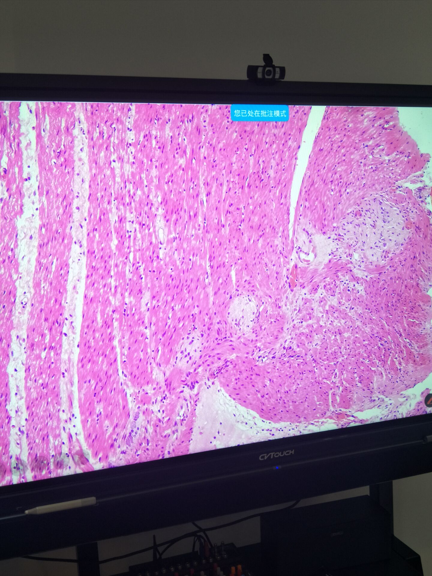  �@΢�R�z���^��(y��ng)�����t(y��)Ժ�h��ҕ�lϵ�y(t��ng)(�D��)